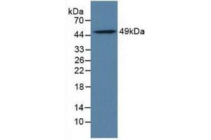 Figure . (LILRB4 Antikörper  (AA 24-206))