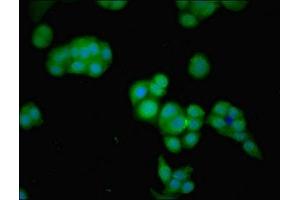 Immunofluorescent analysis of PC-3 cells using ABIN7153900 at dilution of 1:100 and Alexa Fluor 488-congugated AffiniPure Goat Anti-Rabbit IgG(H+L)