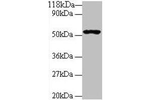 Western blot All lanes: GLP1R antibody at 2 μg/mL + 293T whole cell lysate Secondary Goat polyclonal to rabbit IgG at 1/10000 dilution Predicted band size: 54 kDa Observed band size: 54 kDa (GLP1R Antikörper  (AA 24-145))
