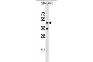 Western blot analysis in SK-BR-3 cell line lysates (35ug/lane). (Ethanolamine Kinase 2 Antikörper  (N-Term))