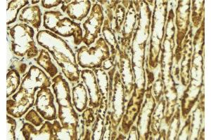 ABIN6278080 at 1/100 staining Mouse kidney tissue by IHC-P. (HIPK2 Antikörper  (N-Term))
