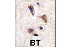 Formalin-fixed and paraffin-embedded human brain tissue reacted with CKK2 antibody (C-term)  , which was peroxidase-conjugated to the secondary antibody, followed by DAB staining. (CAMKK2 Antikörper  (C-Term))