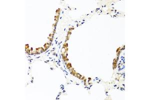 Immunohistochemistry of paraffin-embedded rat lung using COL10A1 antibody (ABIN5974149) at dilution of 1/100 (40x lens). (COL10A1 Antikörper)