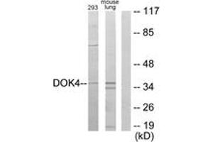 Western blot analysis of extracts from 293/mouse lung cells, using DOK4 Antibody. (DOK4 Antikörper  (AA 11-60))