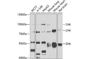 Western blot analysis of extracts of various cell lines, using ZAK antibody (ABIN6133445, ABIN6150360, ABIN6150361 and ABIN6223229) at 1:1000 dilution. (ZAK Antikörper  (AA 1-330))