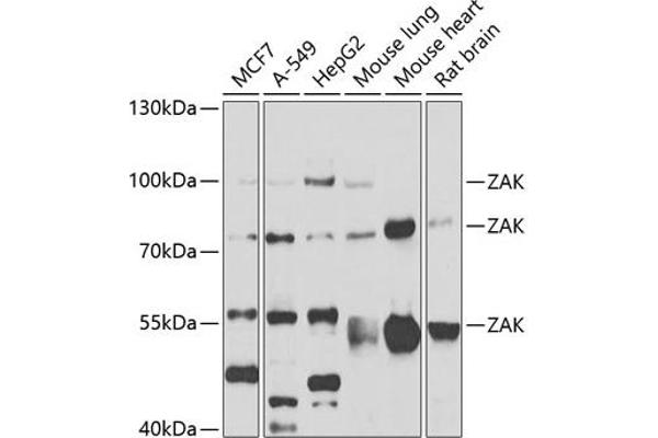 ZAK Antikörper  (AA 1-330)