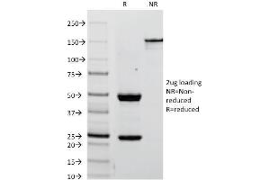 SDS-PAGE Analysis Purified PLAP Mouse Monoclonal Antibody (ALPP/238). (PLAP Antikörper)
