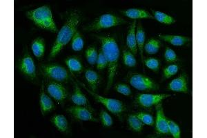 IF analysis of CYB5R3 using anti-CYB5R3 antibody (ABIN7600822). (CYB5R3 Antikörper  (AA 24-301))