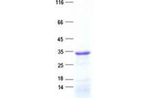Western Blotting (WB) image for Ankyrin Repeat and SOCS Box-Containing 11 (ASB11) protein (His tag) (ABIN2714965)
