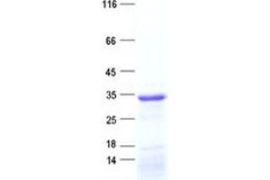 Validation with Western Blot (ASB11 Protein (His tag))