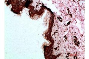 Immunohistochemical analysis of paraffin-embedded human-skin, antibody was diluted at 1:200 (Desmoglein 1 Antikörper  (AA 30-90))