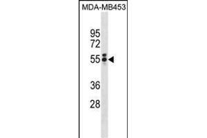 T Antibody (N-term) (ABIN1881864 and ABIN2839039) western blot analysis in MDA-M cell line lysates (35 μg/lane). (T Antigen (AA 15-43), (N-Term) Antikörper)