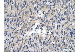 Rabbit Anti-TCEAL1 antibody        Paraffin Embedded Tissue:  Human Heart cell   Cellular Data:  Epithelial cells of renal tubule  Antibody Concentration:   4. (TCEAL1 Antikörper  (Middle Region))