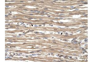 ACTR2 antibody was used for immunohistochemistry at a concentration of 4-8 ug/ml to stain Skeletal muscle cells (arrows] in Human Muscle.