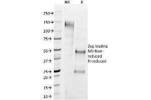 SDS-PAGE Analysis Purified Cytokeratin 1 Mouse Monoclonal Antibody (LHK1). (Cytokeratin 1 Antikörper  (C-Term))