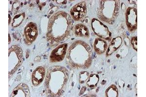 Immunohistochemical staining of paraffin-embedded Human Kidney tissue using anti-SAT2 mouse monoclonal antibody. (SAT2 Antikörper)