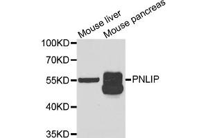 Western blot analysis of extracts of various cell lines, using PNLIP antibody. (PNLIP Antikörper)