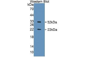 Figure. (TOPBP1 Antikörper  (AA 1-246))
