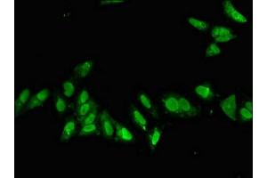 Immunofluorescent analysis of Hela cells using ABIN7155657 at dilution of 1:100 and Alexa Fluor 488-congugated AffiniPure Goat Anti-Rabbit IgG(H+L) (CDX1 Antikörper  (AA 206-245))
