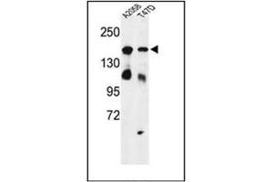 Western blot analysis of Vigilin / HDLBP Antibody (Center) in A2058, T47D cell line lysates (35ug/lane).