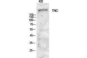 Western Blotting (WB) image for anti-Tenascin C (TNC) (Internal Region) antibody (ABIN6285637)