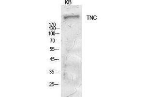 Western Blotting (WB) image for anti-Tenascin C (TNC) (Internal Region) antibody (ABIN3181403)