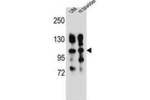 Western Blotting (WB) image for anti-Integrin, alpha 5 (ITGA5) antibody (ABIN2996588) (ITGA5 Antikörper)