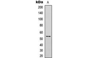 Western blot analysis of p53 (pS392) expression in SKOV3 Etoposide-treated (A) whole cell lysates. (p53 Antikörper  (C-Term, pSer392))