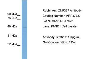 WB Suggested Anti-ZNF367  Antibody Titration: 0. (ZNF367 Antikörper  (Middle Region))