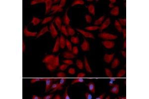 Immunofluorescence analysis of U2OS cells using UBE2I Polyclonal Antibody (UBE2I Antikörper)