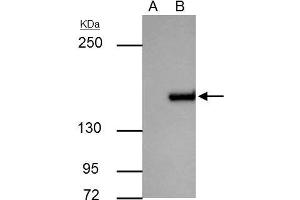 IP Image ROCK1 antibody immunoprecipitates ROCK1 protein in IP experiments. (ROCK1 Antikörper  (N-Term))