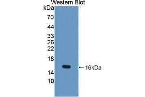 Western blot analysis of the recombinant protein. (TRX2 Antikörper  (AA 60-166))