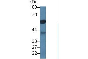 Western Blot; Sample: Porcine Cerebrum lysate; Primary Ab: 1µg/ml Rabbit Anti-Human PPP1Ca Antibody Second Ab: 0. (PPP1CA Antikörper  (AA 2-330))
