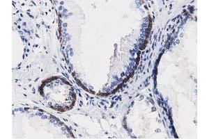 Immunohistochemical staining of paraffin-embedded Human Kidney tissue using anti-ALDH1L1 mouse monoclonal antibody. (ALDH1L1 Antikörper)