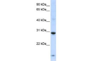 WB Suggested Anti-ZNF138 Antibody Titration:  0. (ZNF138 Antikörper  (Middle Region))