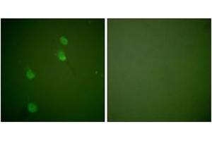 Immunofluorescence analysis of NIH-3T3 cells, using Cullin 2 Antibody. (Cullin 2 Antikörper  (AA 696-745))