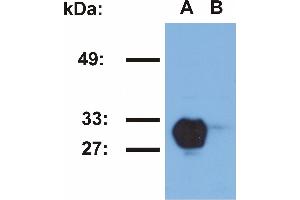 Western blotting analysis of HLA-DR1 in Raji (A) and Jurkat (B) cell lines using MEM-267 antibody. (HLA-DR1 Antikörper  (PE))