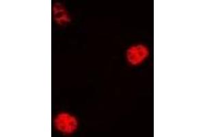Immunofluorescent analysis of Cyclin C staining in Hela cells. (Cyclin C Antikörper)