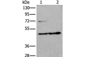 Western blot analysis of HEPG2 cell and Human testis tissue lysates using PRKAR2A Polyclonal Antibody at dilution of 1:550 (PRKAR2A Antikörper)
