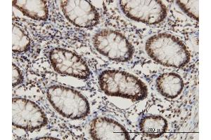 Immunoperoxidase of monoclonal antibody to CHD3 on formalin-fixed paraffin-embedded human colon. (CHD3 Antikörper  (AA 1654-1741))