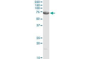 DMPK MaxPab rabbit polyclonal antibody. (DMPK Antikörper  (AA 1-629))