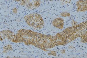 ABIN6266597 at 1/100 staining Human uterus tissue by IHC-P. (MMP7 Antikörper  (C-Term))