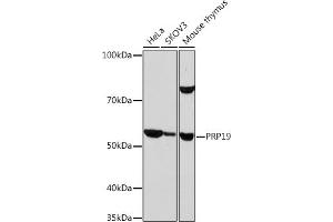 Western blot analysis of extracts of various cell lines, using PRP19 Rabbit mAb (ABIN7269505) at 1:1000 dilution.
