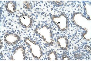 Immunohistochemistry (IHC) image for anti-Ubiquitin-Conjugating Enzyme E2, J1, U (UBE2J1) (N-Term) antibody (ABIN2774737)