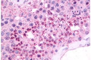 Anti-NMBR antibody IHC staining of human testis. (NMBR Antikörper  (Cytoplasmic Domain))