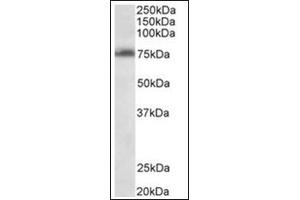 Staining of Jurkat lysate (35µg protein in RIPA buffer) using TSPYL2 antibody at 0. (TSPY-Like 2 Antikörper  (Internal Region))