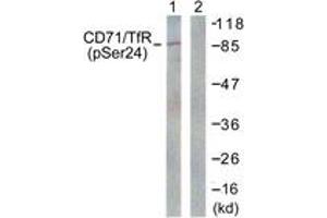 Western blot analysis of extracts from 293 cells treated with PMA 125ng/ml 30' , using CD71/TfR (Phospho-Ser24) Antibody. (Transferrin Receptor Antikörper  (pSer24))
