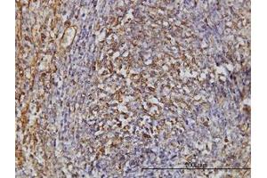 Image no. 1 for anti-Thiopurine S-Methyltransferase (TPMT) (AA 1-246) antibody (ABIN598985) (TPMT Antikörper  (AA 1-246))
