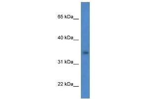 Western Blot showing HSDL1 antibody used at a concentration of 1 ug/ml against HCT15 Cell Lysate (HSDL1 Antikörper  (N-Term))