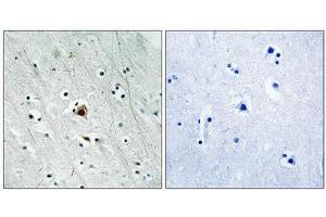 Immunohistochemical analysis of paraffin-embedded human brain tissue using MAPKAPK2 (Phospho-Ser272) antibody (left)or the same antibody preincubated with blocking peptide (right). (MAPKAP Kinase 2 Antikörper  (pSer272))